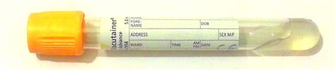 thyroid blood test bottle colour|yellow blood bottle toxicology.